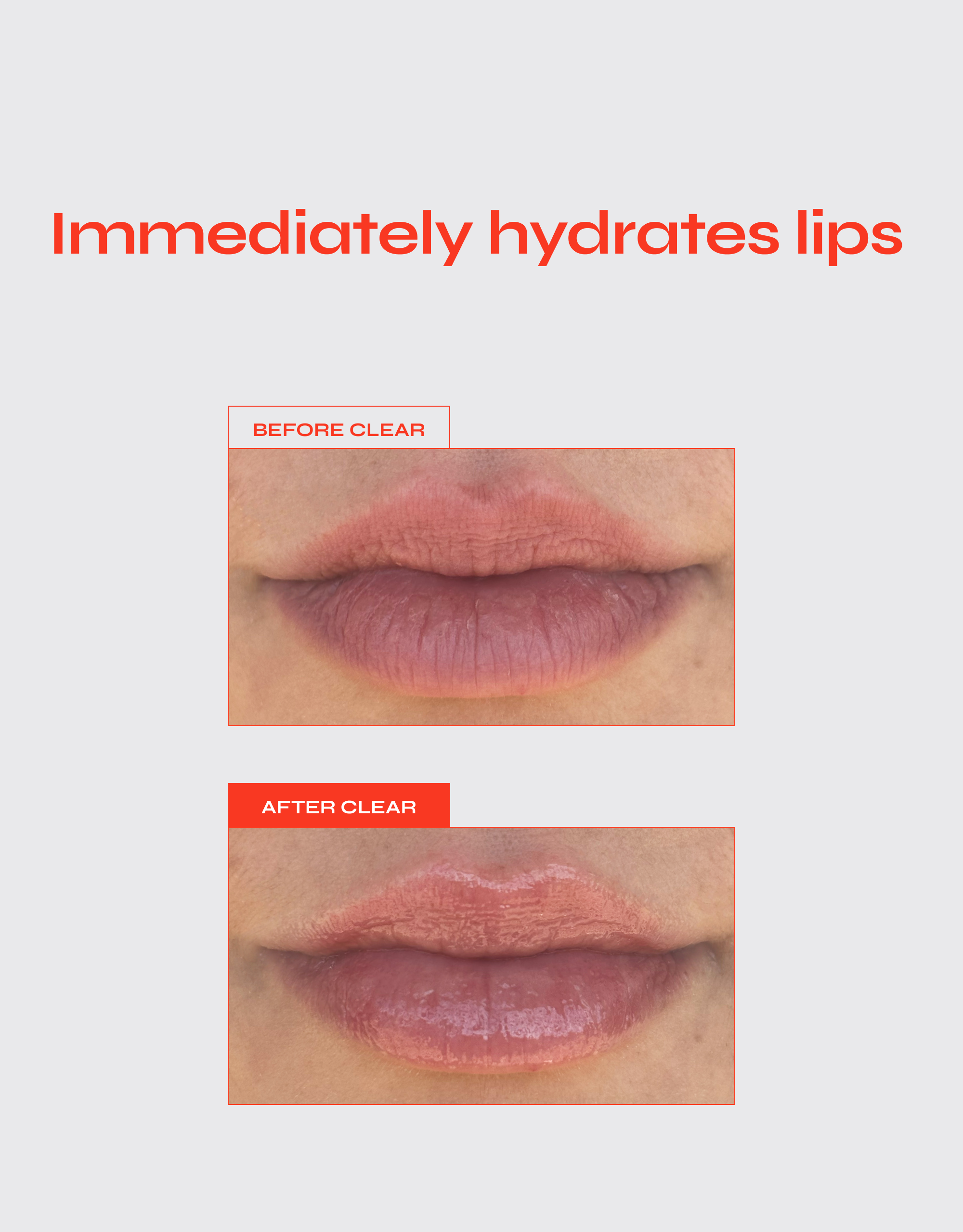 Lip Jelly